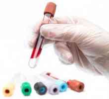 Analiza biochimică a sângelui: norma pentru adulți și copii, indicatorii, cum să descifreze…