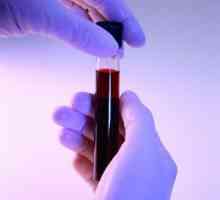 Analiza biochimică a sângelui: prepararea, deținerea, decodarea și rata