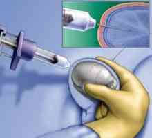 Biopsia de testicule la bărbați: probe și procedură.