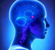 Pituitară - cauze Cushing, simptome, și ghidurile de tratament diashnostika
