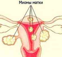 Durere în abdomen și spate în timpul menopauzei