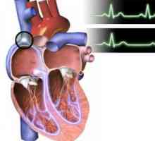 Bradicardie (frecvență cardiacă scăzută) la copii și adulți: specii, origine, simptome, diagnostic,…