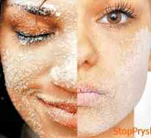 Hopuri pielii faciale: elimina lipsa de