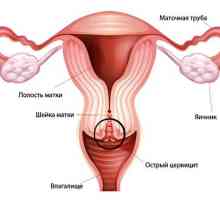 Ectopie de col uterin de col uterin și cervicită cronică