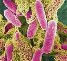 Periculoase Escherichia coli? Ce se întâmplă dacă urină a fost găsit Escherichia coli?