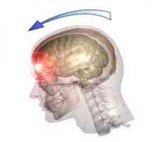 Leziuni traumatice ale creierului (TBI), un traumatism cranian: cauze, tipuri, simptome, tratament