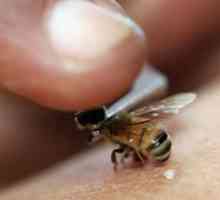 Ce să facă și ce pentru a elimina umflarea de la muscatura de viespi, albine și țânțari