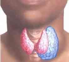 Ce să facă și cum să trateze atunci când mărită glandei tiroide?