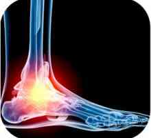Ce se poate face cu osteoartrita a piciorului?