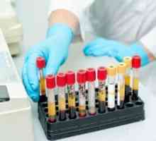 Ce ar trebui să conțină o analiză de sânge uman normal sănătos