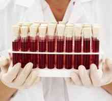 Cauzele cresterea proteinei în sânge și posibilele boli