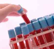 Ce este - un test de sange Petit: valoare, normă și riscul de abateri de la norma