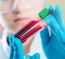 Ce este - GGT: programare pentru un test de sânge, rata de enzimă și o posibilă boală