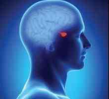 Ce este IRM pituitară?