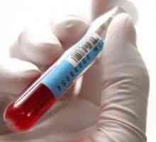 Norma alp în analiza biochimică a sângelui și provoacă anomalii enzimatice