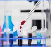 Ce face un test de sânge pentru CEA și de ce ar trebui să ia?
