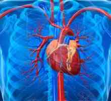 Ce înseamnă diagnosticul „difuze cardio“?