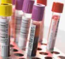 Ce este un ASAT test de sânge și atunci când avem nevoie pentru a lua