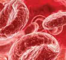 5 Moduri de bază pentru a crește hemoglobina din sânge