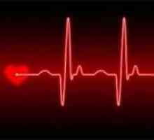 Ce este aritmie cardiacă și dacă este periculos pentru viață?
