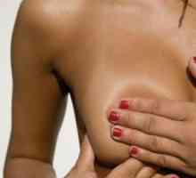 Ce este difuză fibro-chistice glandele mamare de san? Totul despre boala