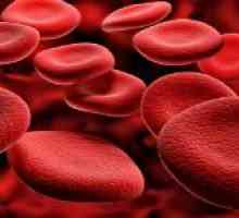Ce este sângele haemoscanning și ceea ce este utilizat?