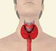 Ce este coloidal gușa tiroidiană
