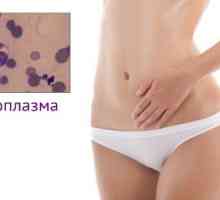 Simptomele și tratamentul gominis mycoplasma