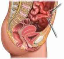 Ce este o obstrucție intestinală este și de ce apare?