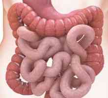 Ce este perforarea intestinului?