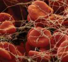 Ce este coagularea sângelui și cum să se determine