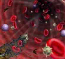 Ce este lupus anticoagulant și valoarea sa de diagnostic