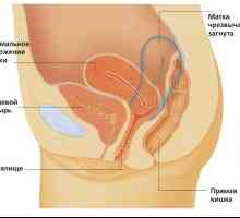 Ce este cot de col uterin și a tipurilor sale?