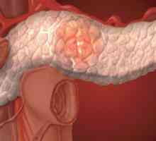 Care sunt cauzele modificările reactive ale pancreasului?