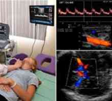 Capacitățile de diagnosticare ale vaselor cerebrale cu ultrasunete