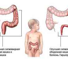 Diagnosticul și tratamentul dolihosigmoy copilului