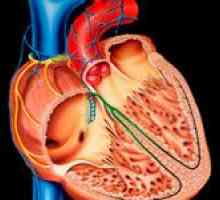 Cardiomiopatia dilatativă (DCM) și tratamentul acesteia