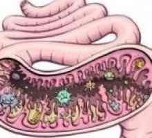 Dysbiosis intestinal - ce este? Să vedem