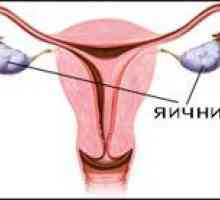 Disfuncții ovariene (tulburări de lucrări ovariene)
