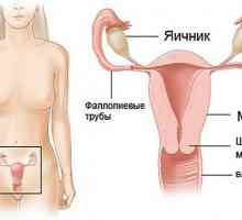 Disfuncții ovariene: primul semnal de absență mentruatsy