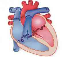 Disfuncție a miocardului ventricular: cauze, simptome, tratament