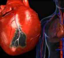 Distrofia ventricular și tratamentul acesteia