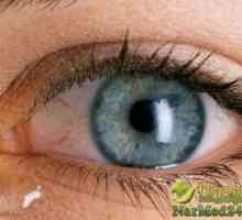 Acasă și ajutoarele necesare pentru arsuri ochilor: remedii populare și tratamente