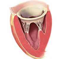 Coardă suplimentară (trabecula) a ventriculului stâng al inimii: conceptul, prognoza
