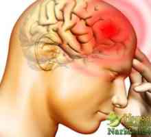 Disponibil remedii populare Tratamentul migrenei