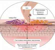 Factori care provoacă dermatită la mamele care alăptează, precum și metodele de a scăpa de el