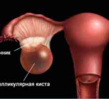 Foliculare ovariene: Simptome Chisturi, Diagnostic și Tratament Sarcina