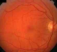 Context eye retinopatia