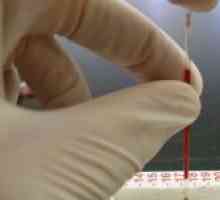 Hematocrit în sângele femeilor