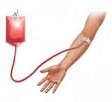 Transfuzie de sânge (transfuzie de sânge): Provocări și soluții, lectură, deținerea, ingrediente